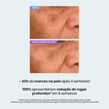 S&eacute;rum Antissinais Sallve 30g