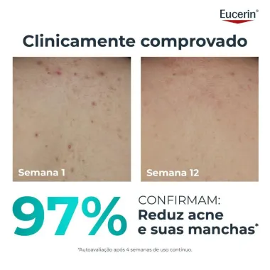 Eucerin Dermopure Creme Corporal Efeito Triplo 200ml