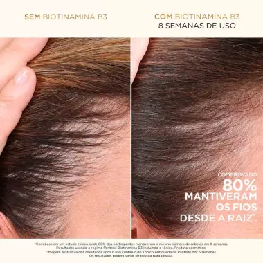 Condicionador Pantene Pro-V Miracles Biotinamida B3 Antiqueda e Nutrição 150ml