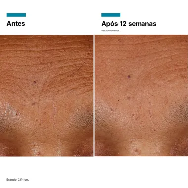 Sérum Volumizador SkinCeuticals HA Intensifier Multi Glycan Correção 30ml