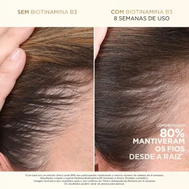 Condicionador Antiquebra Pantene Pro-V Miracles Biotinamina B3 Antiqueda e Nutri&ccedil;&atilde;o 1L