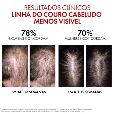 S&eacute;rum Regenerador Dercos Vichy Aminexil Clinical Antiqueda 100ml