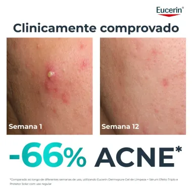 Eucerin Dermopure Clinical S&eacute;rum Efeito Triplo 40ml