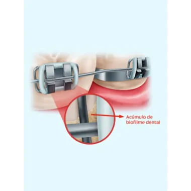 Escova Dental Colgate OrthoGard Macia Cores Sortidas 1 Unidade