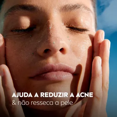 Esfoliante Facial Diário Nivea Acne Control 75ml