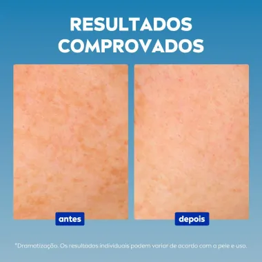Nívea Luminous 630 Sérum Facial Avançado Antimarcas Escurecidas 30ml