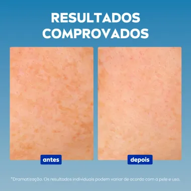 Nívea Luminous 630 Sérum Facial Avançado Antimarcas Escurecidas 30ml