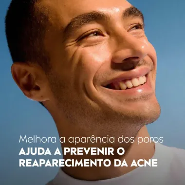 Sabonete Facial em Gel Nivea Acne Control 150g