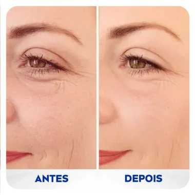 Preenchedor Nivea Q10 Expert Antissinais 15ml