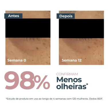 Eucerin Anti-Pigment Área dos Olhos Clareador de Olheiras 15ml