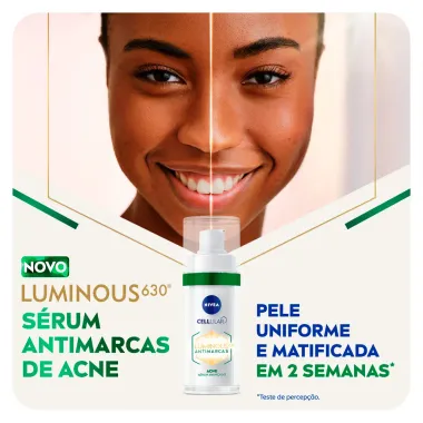 Sérum Nivea Cellular Luminous 630° Antimarcas Acne 30ml Verso