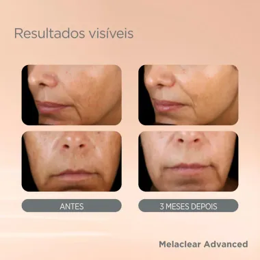 S&eacute;rum Facial Clareador Isdinceutics Brighten Melaclear Advanced 30ml